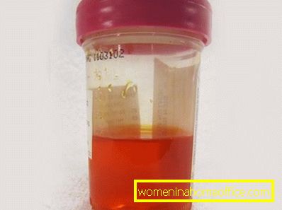 causes of red urine