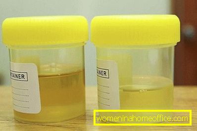 Turbid urine